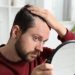 Sons – Possible Treatment Plans for Hair Loss