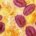 Baguio activates dedicated health team vs Mpox