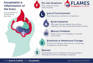 Encephalitis can look like common illness; experts urge public to learn “FLAMES”